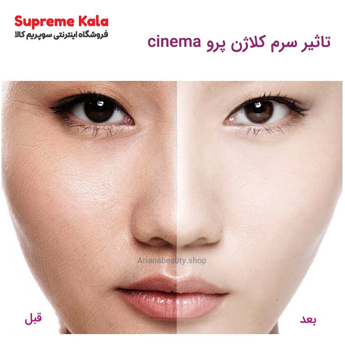 سرم کلاژن پرنده cinema