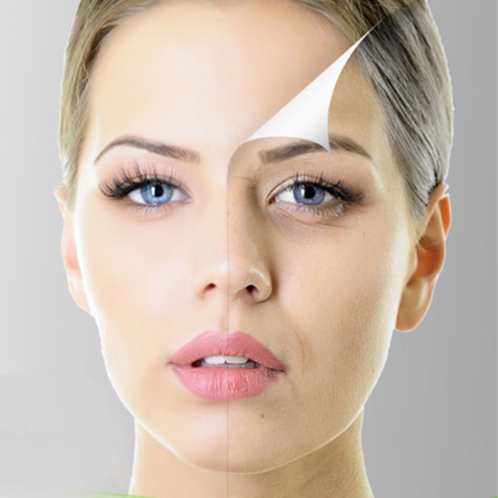 لایه بردار شیمیایی SKIN PREP SOLUTION تنورا 50 میل
