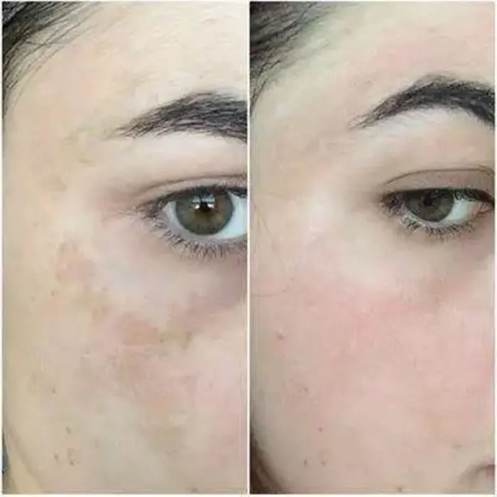 LS - کرم ضد لک قوی و درخشان کننده SPF30 دکتر بلتر 100 میل