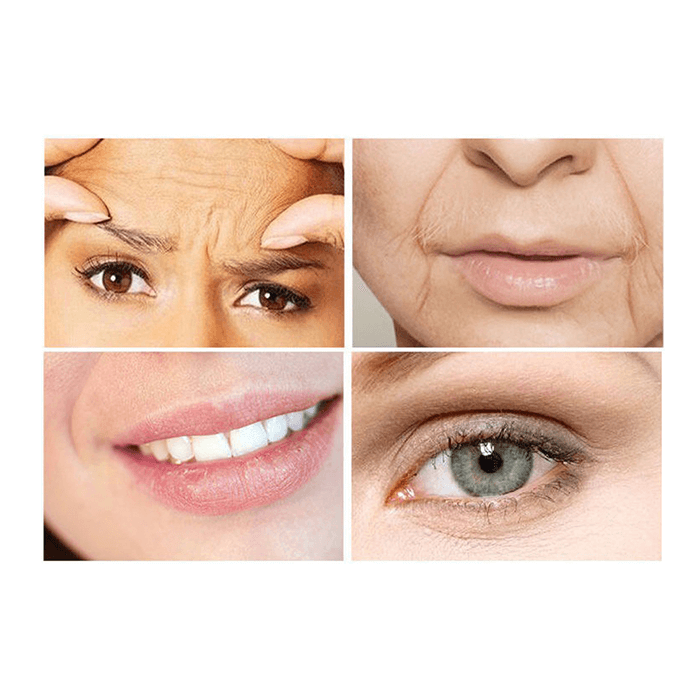 نخ کلاژن ساز جذبی بدون تزریق کره ای EELHOE