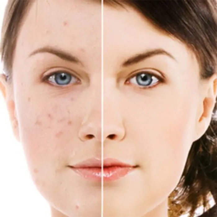 LS - کرم ضد لک قوی و درخشان کننده SPF30 دکتر بلتر 50 میل