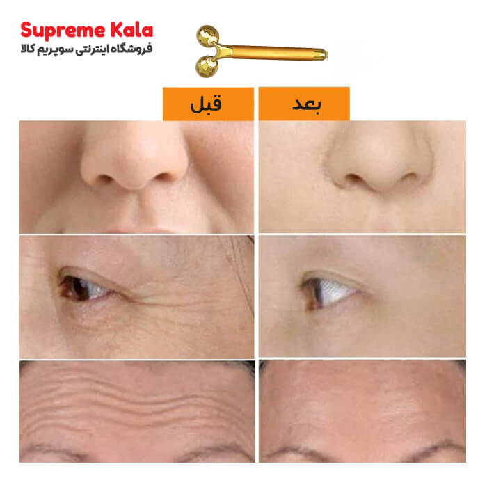 ماساژور دو سر بیوتی بار