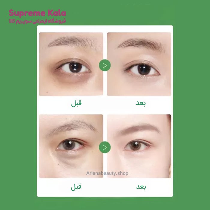کرم گیاهی دور چشم آواکادو بیوآکوا