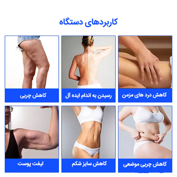 دستگاه لاغری کویتیشن آر اف 6 هندپیس 40 کیلوهرتز 5D