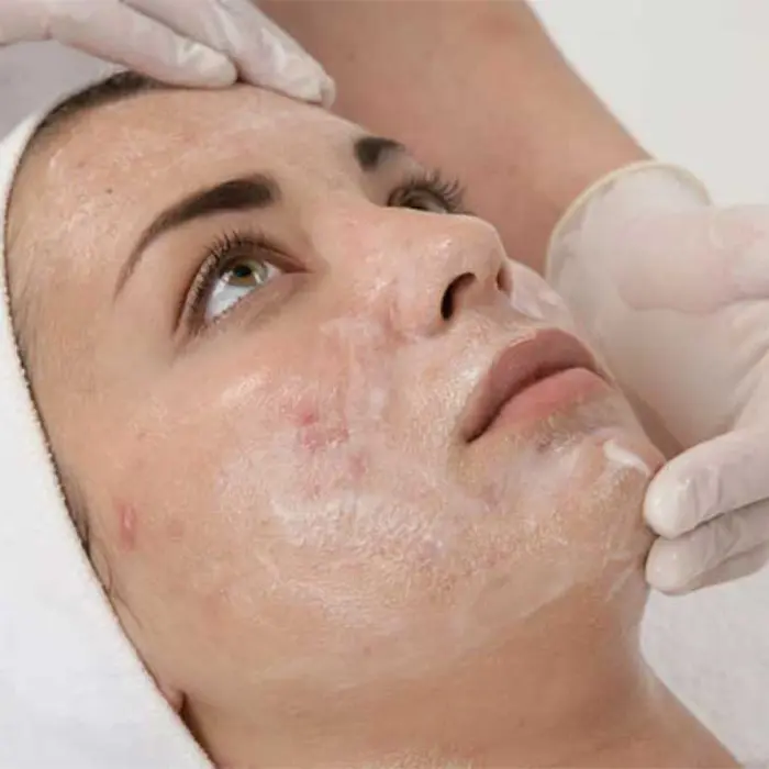 اسید های میوه 20 % دکتر بلتر 50 میل