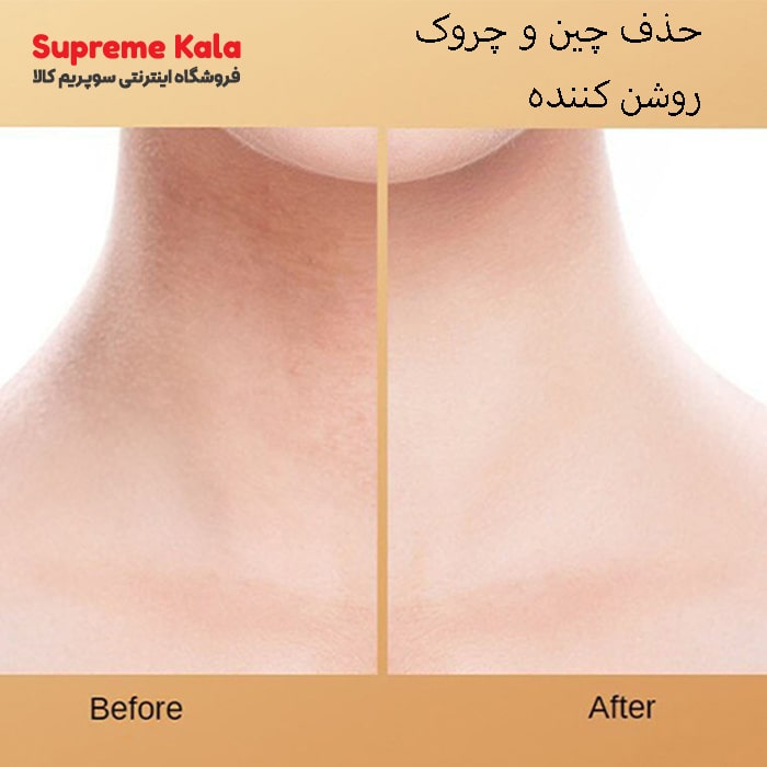 ماسک ورقه‌ای گردن بیوآکوا عصاره شیر بز و کلاژن