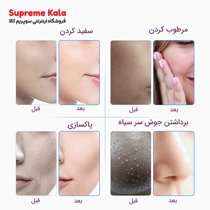 هیدروفیشیال 7 کاره نیوفیس موتور سنگین برند لیز