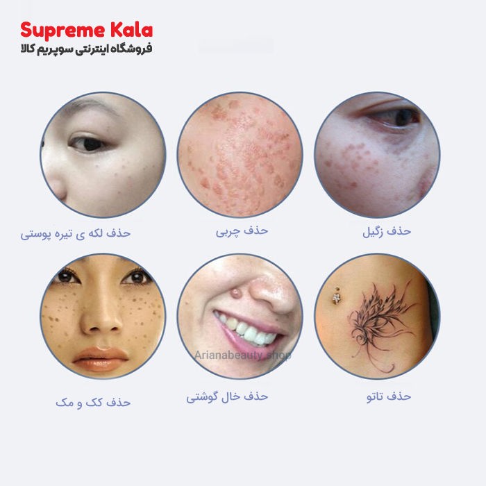 دستگاه هیدرودرمی گالوانیزه 5 کاره